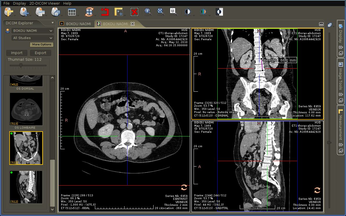 download the new version for mac Sante DICOM Viewer Pro 14.0.2